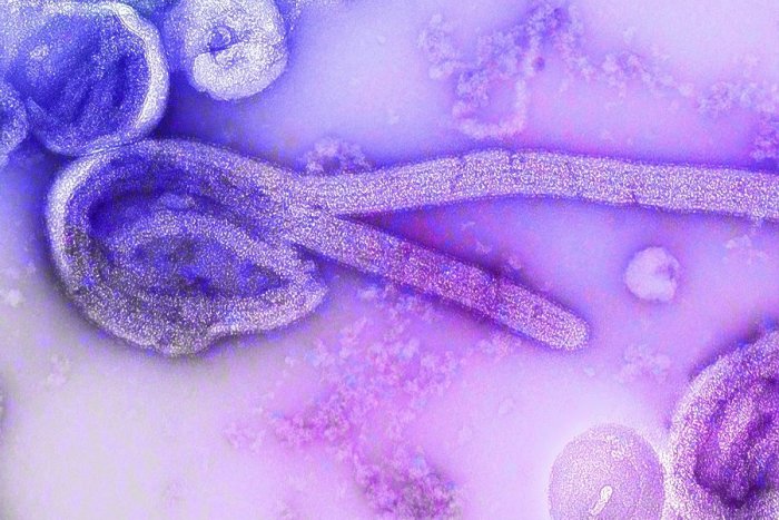 Ilustračný obrázok k článku Ebola je PORAZENÁ! Podarilo sa to vďaka vakcínam a liečbe, tvrdí virológ