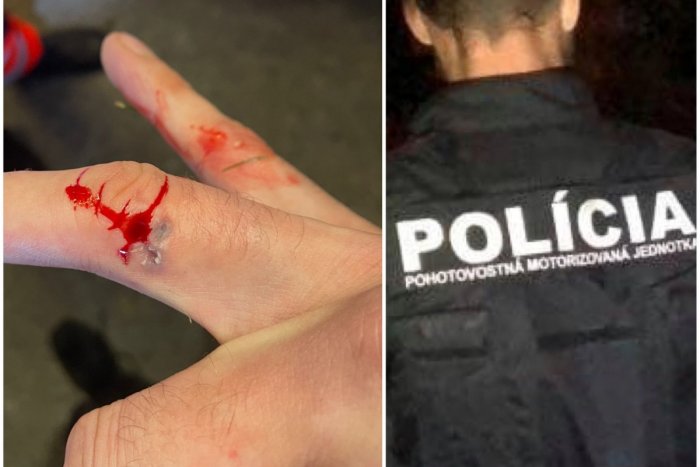 Ilustračný obrázok k článku Muž napadol trnavských policajtov a jedného POHRÝZOL! Spacifikovali ho až paralyzérom