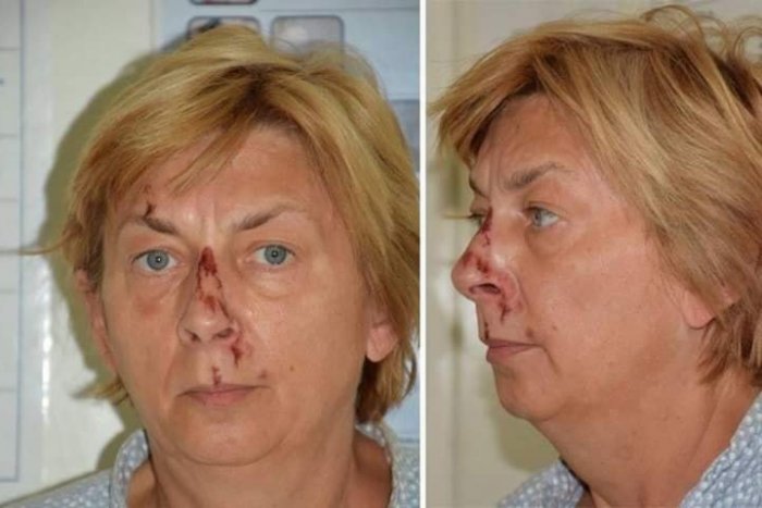 Ilustračný obrázok k článku Hľadaná žena so stratou pamäti v Chorvátsku je Daniela Adamcová, rodáčka z Trenčína