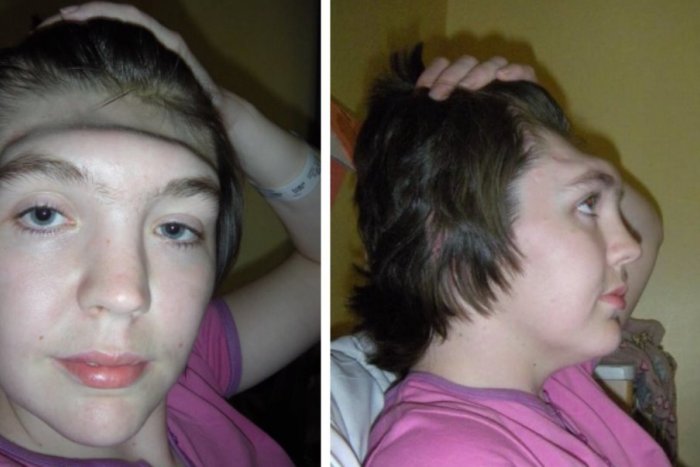 Ilustračný obrázok k článku V aute si vyložila nohy na palubnú dosku: Dievča ostalo BEZ ČELA, môže sa to stať i vám!