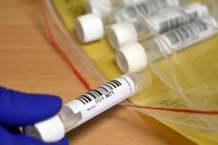 Ilustračný obrázok k článku Koronavírusu podľahlo ďalších 27 ľudí. Pribudli tiež stovky nových prípadov nákazy