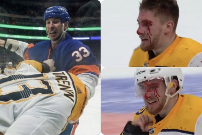 Ilustračný obrázok k článku Veterán Chára zhodil rukavice: Ruského mladíka ZMLÁTIL do krvi! VIDEO a FOTO