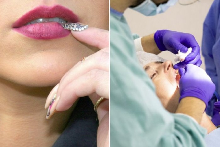 Ilustračný obrázok k článku Obhrýzate si nechty? Nie je to nevinný zlozvyk, môžete prísť aj o zuby!