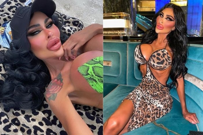 Ilustračný obrázok k článku DESIVÉ ZÁBERY živej Barbie: Kráľovná plastík chce ísť opäť pod nôž, lekári bijú na poplach