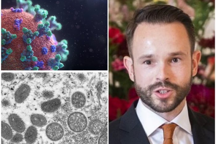 Ilustračný obrázok k článku NARUŠIA opičie kiahne alebo koronavírus dovolenkovú sezónu? Odborník Sabaka má v tom JASNO!