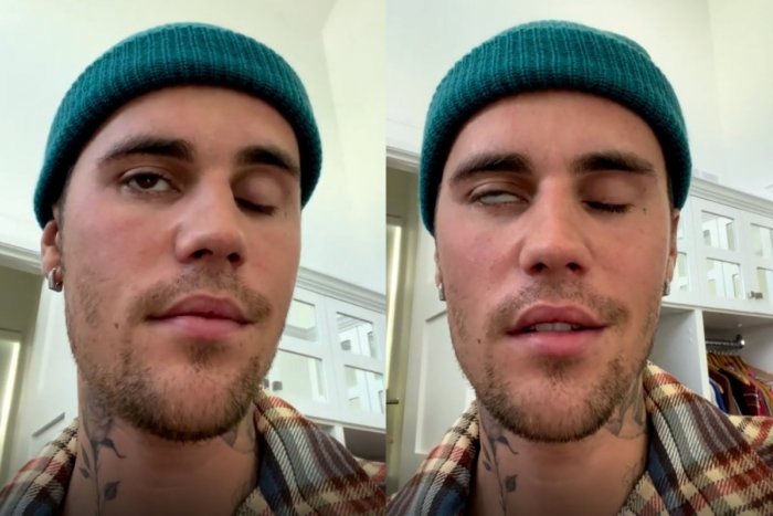 Ilustračný obrázok k článku Milióny fanúšičiek ostali v ŠOKU: Justin Bieber priznal CHOROBU, ruší koncerty