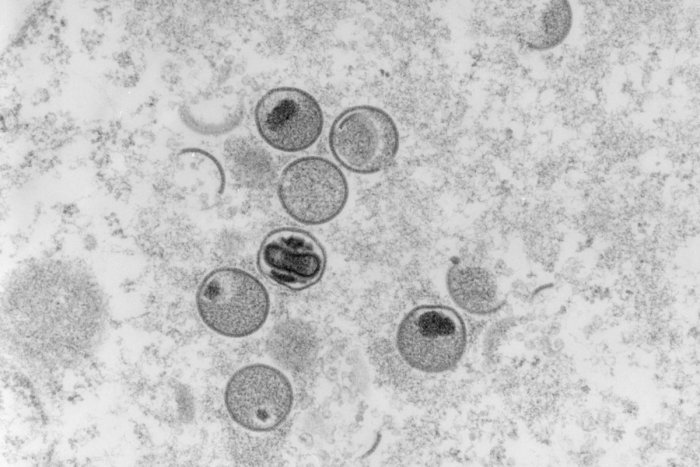 Ilustračný obrázok k článku Vírus opičích kiahní sa správa NEZVYČAJNE: Bude vyhlásený celosvetový stav zdravotnej NÚDZE?