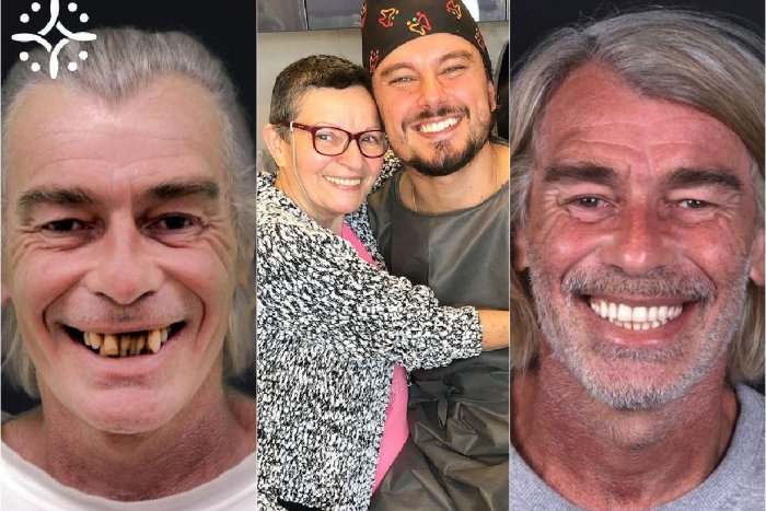 Ilustračný obrázok k článku Zubár ZADARMO opravuje chrup: Pacientov zmenil na nepoznanie! FOTO