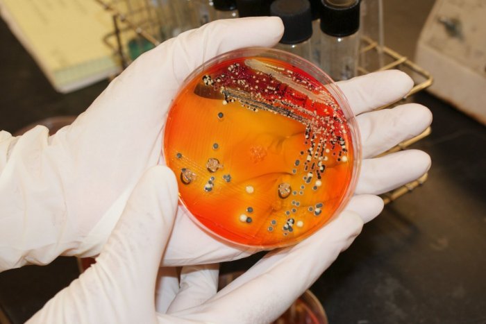 Ilustračný obrázok k článku Vyhnite sa v lete salmonelóze: Odborník RADÍ, na čo všetko si dať POZOR