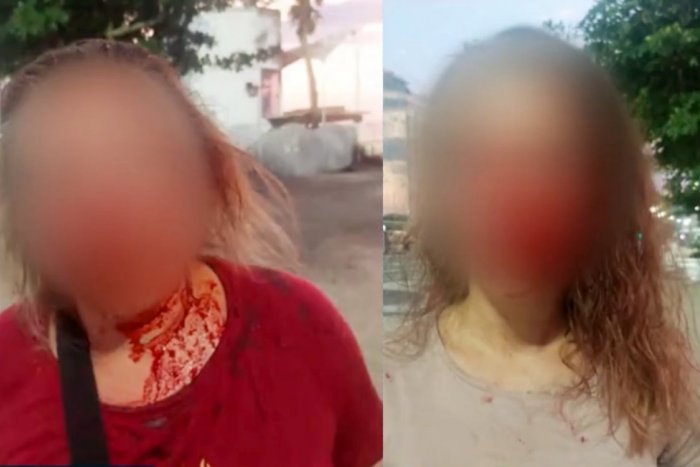 Ilustračný obrázok k článku SVET O SLOVENSKU: Na svetoznámej brazílskej pláži brutálne dobili dve Slovenky!