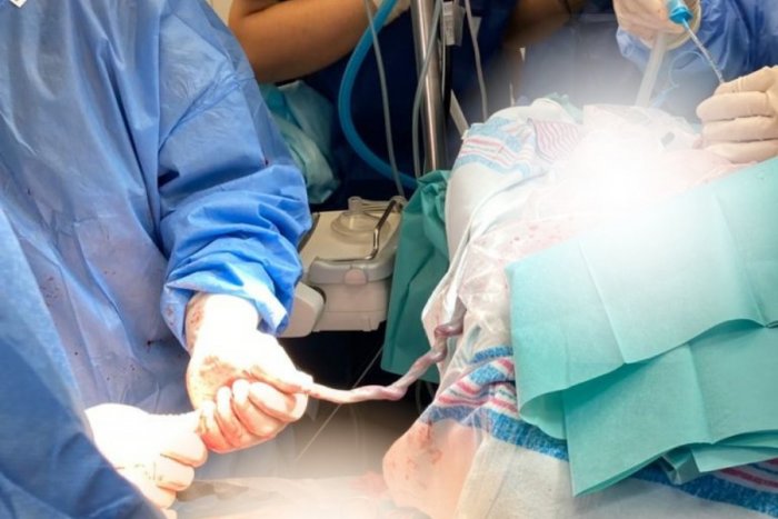 Ilustračný obrázok k článku UNIKÁTNA operácia v Bratislave: Bábätko operovali ešte kým bolo spojené s mamou pupočnou šnúrou