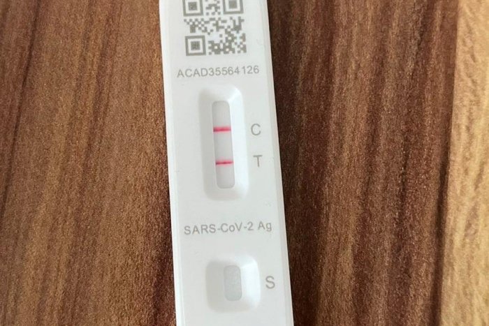 Ilustračný obrázok k článku Mali ste koronavírus viac ako raz? POZOR, je u vás vyššie riziko predčasného ÚMRTIA!