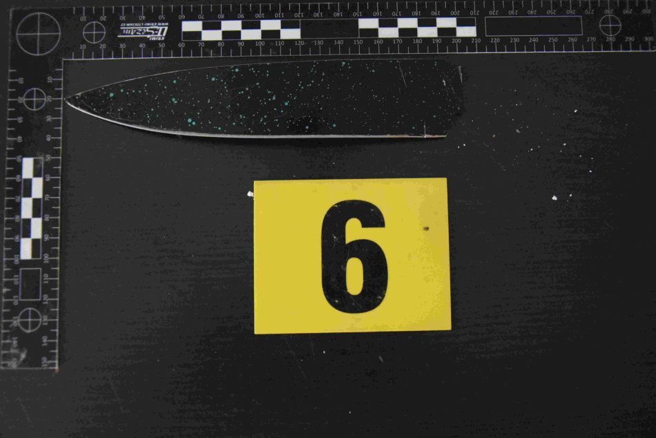 Ilustračný obrázok k článku Krvavý ÚTOK na Podpoľaní: Žena po hádke DOBODALA muža nožom, FOTO