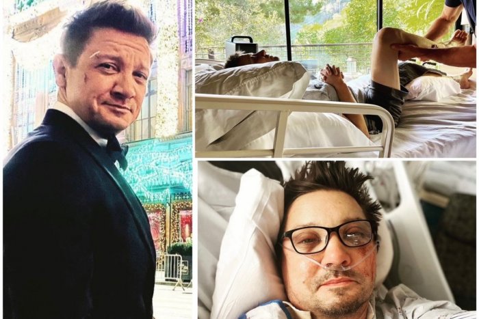 Ilustračný obrázok k článku SUPERHRDINA vo filme aj v skutočnom živote: Herca prešiel pluh, má vyše 30 zlomenín!