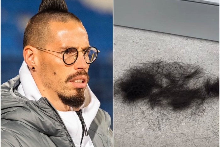 Ilustračný obrázok k článku Totálna ZMENA po rokoch: Hamšík zhodil povestné ČÍRO a dal to na "slušáka"! FOTO