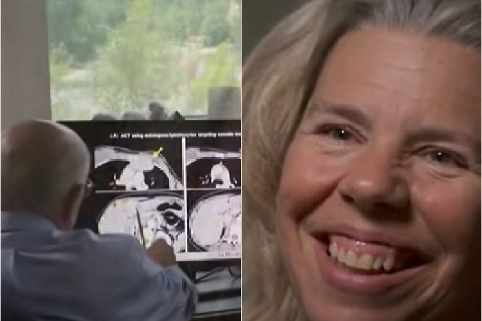 Ilustračný obrázok k článku Žena trpela RAKOVINOU a zostávali jej tri roky života: Akou liečbou PORAZILA chorobu?