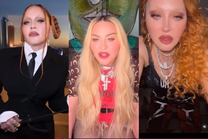Ilustračný obrázok k článku OPUCHNUTÁ a DESIVÁ? Madonna sa vyjadrila k plastikám, neprajníkov poriadne zotrela
