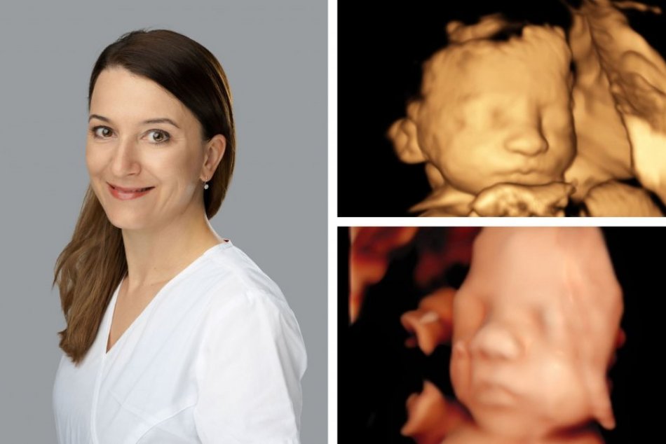 Ilustračný obrázok k článku NOVINKA pre budúce mamičky: Vo zvolenskej nemocnici je 3D a 4D sono, KOĽKO zaplatíte?