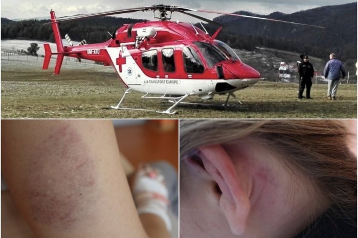 Ilustračný obrázok k článku HROZNÉ detaily útoku SPLAŠENÝCH kráv: Mladá žena bude mať TRAUMU na celý život! FOTO