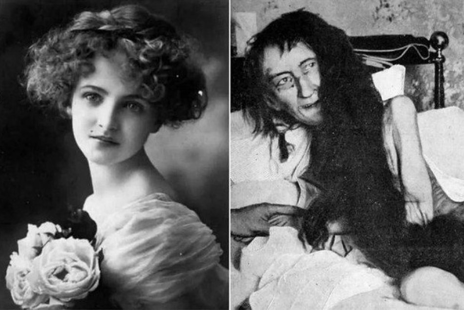 Ilustračný obrázok k článku Matka zničila krásnej dcére život: VÄZNILA ju 25 rokov v komore za niečo, po čom túžime VŠETCI