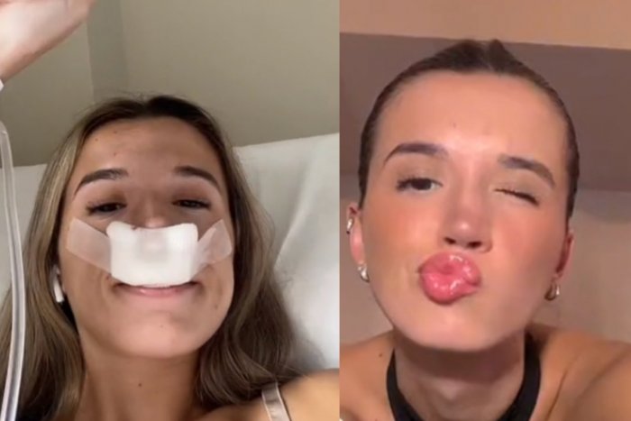 Ilustračný obrázok k článku Influencerka vo videu ŠOKUJE: Išla som na plastiku, aby sa moje DETI narodili s peknými nosmi