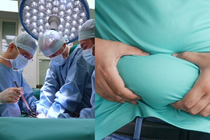Ilustračný obrázok k článku Nemocniciam robia problémy morbídne OBÉZNI pacienti: Potrebujú aj ŠPECIÁLNE operačné stoly