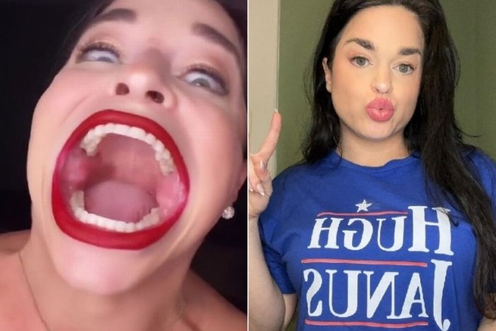 Ilustračný obrázok k článku Ako dieťa bola šikanovaná: Samantha má najväčšie ÚSTA na svete a kráľovsky na tom zarába!