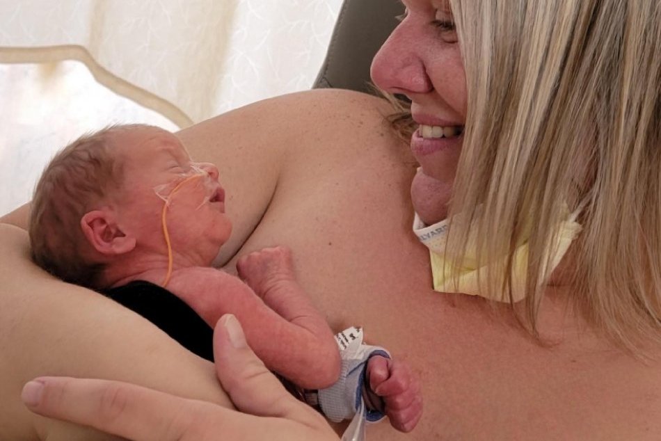 Ilustračný obrázok k článku Dievčatko sa narodilo s orgánmi MIMO tela: Takto DNES vyzerá malá bojovníčka!