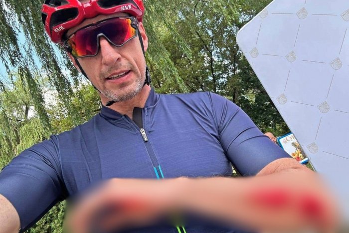 Ilustračný obrázok k článku Župan Majerský vystrašil voličov: Na Facebooku ukázal nepríjemné KRVAVÉ zranenie