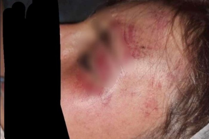 Ilustračný obrázok k článku Brutálna BITKA v Hlohovci: Len 12-ročného chlapca dobila skupina tínedžerov