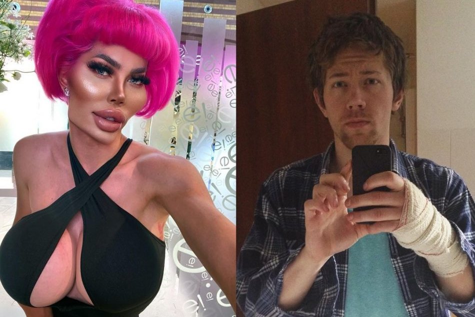 Ilustračný obrázok k článku FOTO: Jan sa chce čo najviac podobať na Barbie: Jeho neuveriteľná premena NEKONČÍ!