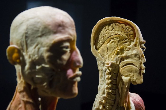 Ilustračný obrázok k článku Kontroverzná výstava ľudských TIEL v Bratislave má dohru: Organizátor dostal 30-TISÍCOVÚ pokutu