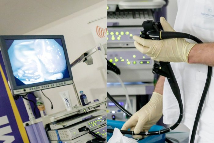 Ilustračný obrázok k článku Muž podstúpil preventívnu kolonoskopiu: Nález v jeho črevách šokoval aj lekárov!