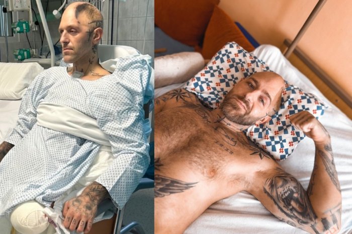 Ilustračný obrázok k článku Namiesto klietky boj v nemocnici o holý život: Zápasník MMA to nevzdal, rodina žiada o pomoc!