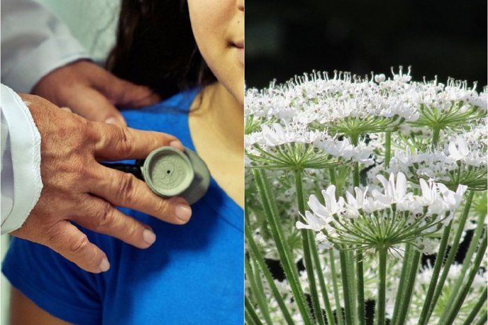 Ilustračný obrázok k článku Žena sa otrávila v záhrade jedovatou BURINOU, ktorá rastie aj u nás: Protijed NEEXISTUJE!