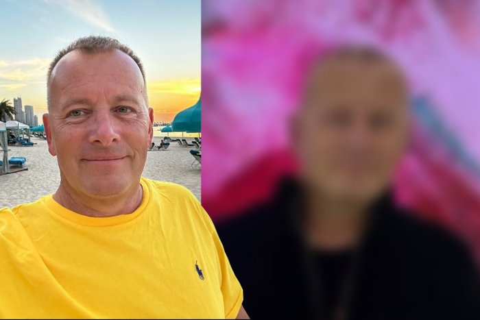 Ilustračný obrázok k článku Zbohom, rozširujúce sa kúty! Milenka Borisovi Kollárovi zacvakala TRANSPLANTÁCIU vlasov