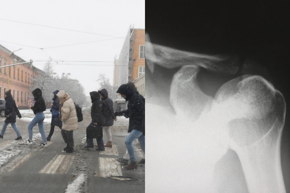 Ilustračný obrázok k článku V Košiciach sa vo veľkom LÁMU kosti! Z UNLP hlásia maximálne vyťažené urgenty