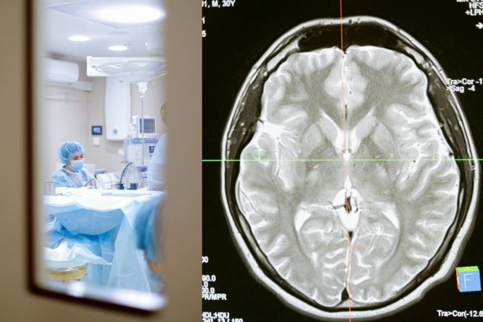 Ilustračný obrázok k článku MŔTVICA ohrozuje aj deti! Adamka (8) zachránili na poslednú chvíľu