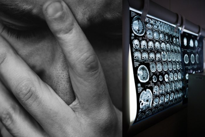 Ilustračný obrázok k článku Nechcete dostať Alzheimera? Vedci RADIA: Venujte sa TEJTO aktivite!