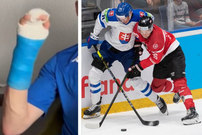 Ilustračný obrázok k článku RANA pre trénera Ramseyho! Na MS nemôže počítať s týmto obrancom, ZLOMIL si ruku