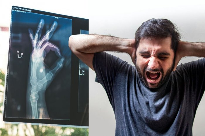 Ilustračný obrázok k článku Muža MUČILA vzácna porucha: Desil sa vlastných prstov, dal si ich AMPUTOVAŤ