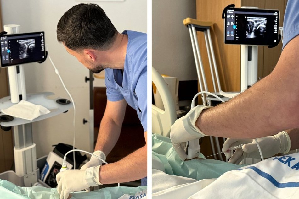 Ilustračný obrázok k článku Bystrická nemocnica získala nový SONOGRAF: Pacientom pomôže priamo na lôžkach, FOTO