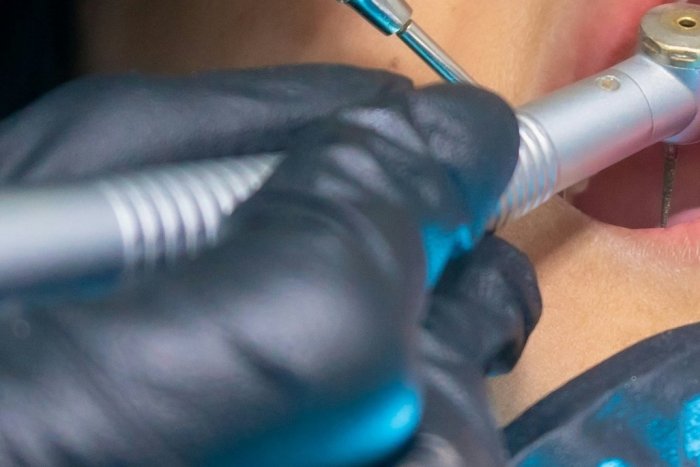 Ilustračný obrázok k článku SMRŤ po návšteve zubára: Mladému dievčaťu (†23) vytrhli zub múdrosti, o pár dní ZOMRELA