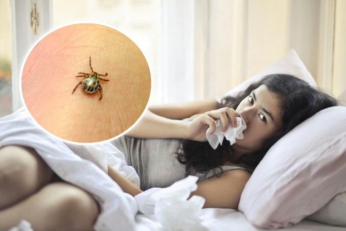 Ilustračný obrázok k článku Prípadov kliešťovej encefalitídy ENORMNE pribúda: Banskobystrický kraj je postihnutý NAJVIAC