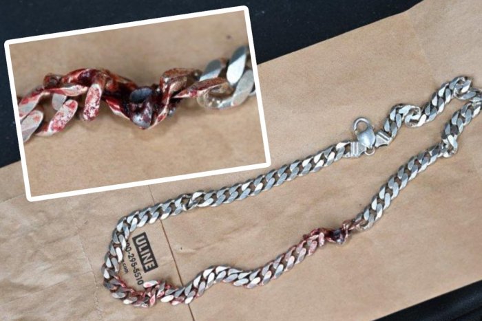 Ilustračný obrázok k článku Môže hovoriť o ZÁZRAKU! Na muža vystrelili, projektil ZASTAVILA retiazka