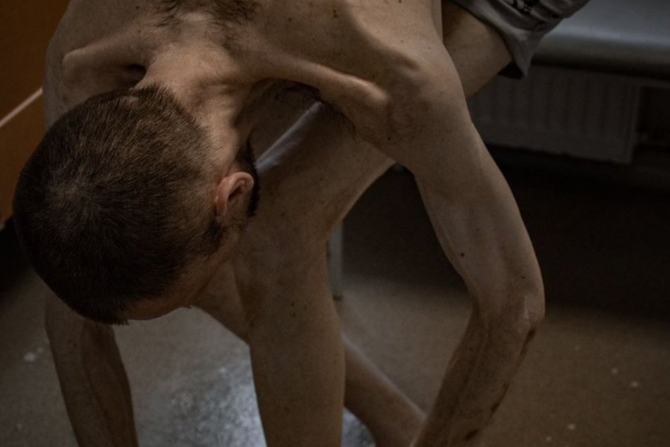 Ilustračný obrázok k článku Desivé FOTO ukrajinských zajatcov v Rusku: Vyzerajú ako z koncentračných táborov SMRTI