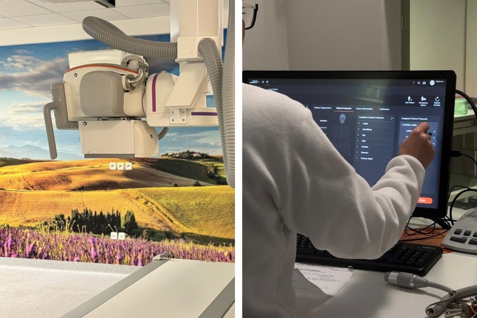 Ilustračný obrázok k článku NOVINKA v bystrickej nemocnici: Pacientom poslúži NAJRÝCHLEJŠÍ röntgen na Slovensku, FOTO