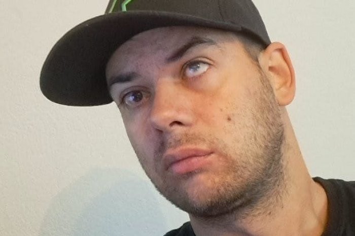 Ilustračný obrázok k článku 27 operácií očí, no aj tak príde o zrak. Zachráni si aspoň chrup?