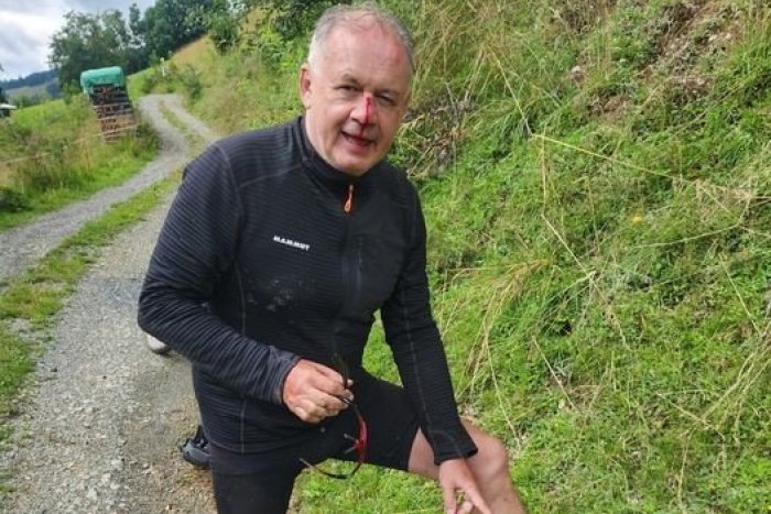 Ilustračný obrázok k článku Kiska so ZAKRVAVENOU tvárou! Čo sa mu stalo a k čomu vyzýva Slovákov?