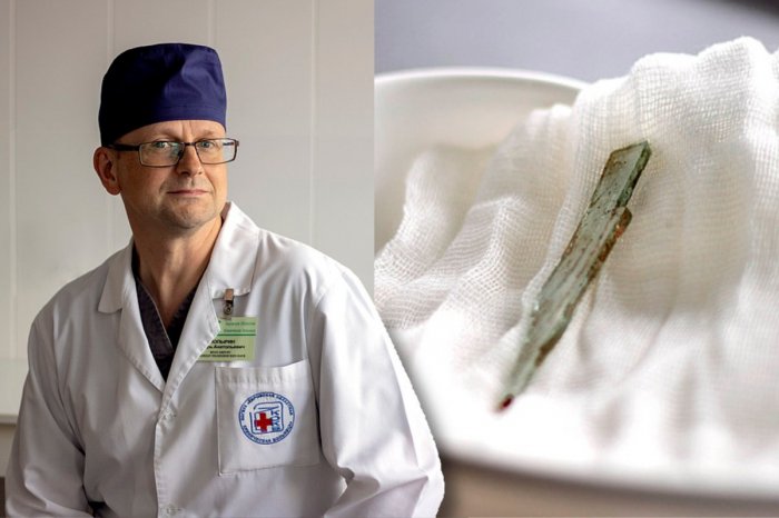 Ilustračný obrázok k článku Rusa 10 ROKOV trápili bolesti pod rebrami: V pečeni mu našli 9-CENTIMETROVÝ kus skla